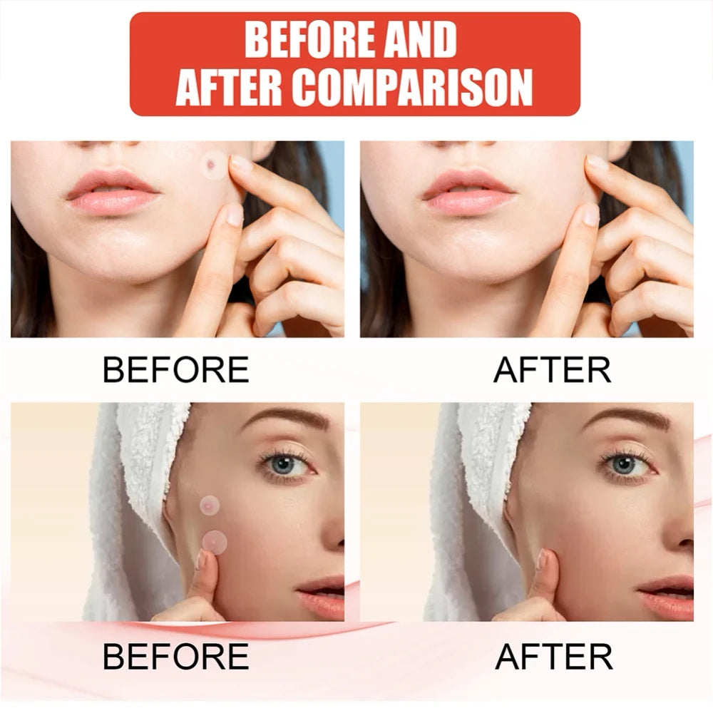 Clear Skin Patches